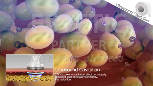 EunSung BeautyPot - Ultrazvuková kavitácia
